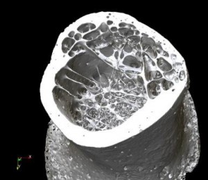 3D micro-CT rendering of a proximal human radius bone.