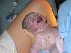 Evidence linked low birth weight and prematurity - risk factors for high blood pressure and chronic kidney disease later in life.
