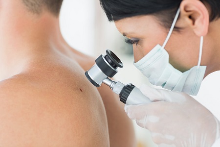 "There is a desperate need for improved treatments that stop and reverse (melanoma)."