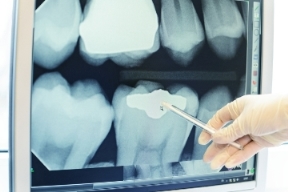 Patients and practitioners could benefit from a faster and more user-friendly dental x-ray solution.