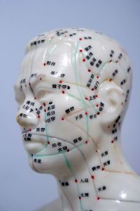 "There have been a number of small studies examining the benefits of acupuncture after xerostomia develops, but no one previously examined if it could prevent xerostomia."