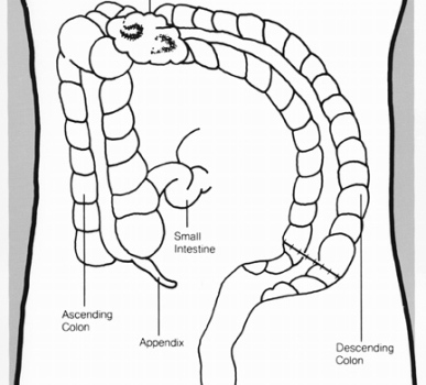 "Treating appendicitis conservatively has "major certain disadvantages" as the reoccurrence rate of appendicitis is up to 20 per cent in the first year."