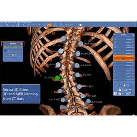 3D Imaging System | 3D Spine