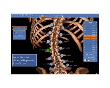 Sectra - 3D Imaging System | 3D Spine