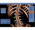 Sectra - 3D Imaging System | 3D Spine