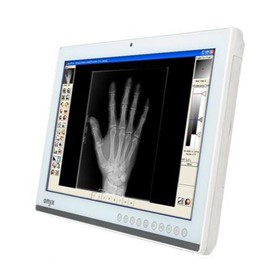 Patient Monitor and Smart View – Zeus Series