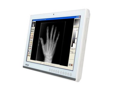 Onyx - Patient Monitor and Smart View – Zeus Series