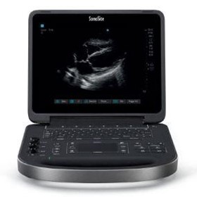Portable Ultrasound Machine - Edge II