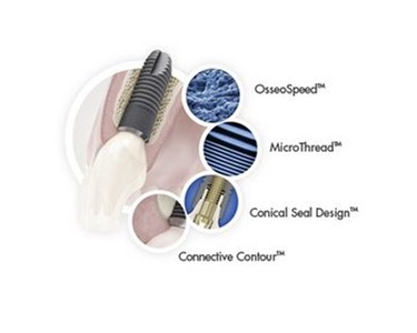 Dental Implant System | BioManagement Complex™