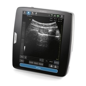 Portable Ultrasound System | Venue 50
