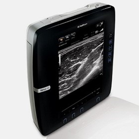 Portable Ultrasound System | Venue 40