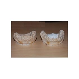 Dental 3D Scanner | Solutionix DS