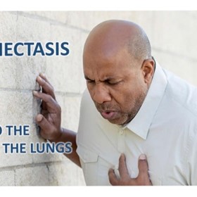 Bronchiectasis and Damage To The Airways In The Lungs