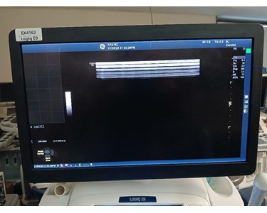 GE - Logiq E9 Ultrasound EX4162