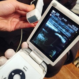 Expanding access to health care in Papua New Guinea with handheld ultrasound