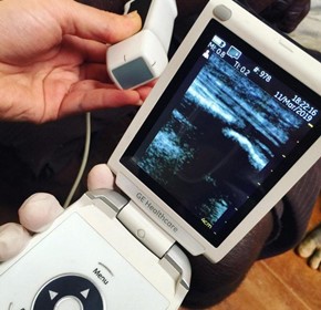 Expanding access to health care in Papua New Guinea with handheld ultrasound Expanding access to health care in Papua New Guinea with handheld ultrasound