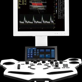 Ultrasound Systems | Vinno X1