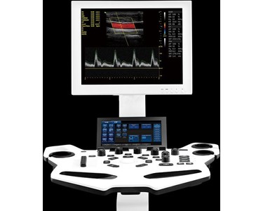 Vinno - Ultrasound Systems | Vinno X1