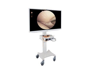 Surgical Imaging System | LENS 4K