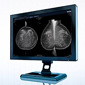  2D Imaging Systems I Breast Imaging PACS and RIS