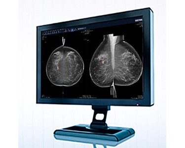 Sectra -  2D Imaging Systems I Breast Imaging PACS and RIS
