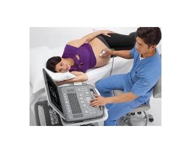 Siemens Healthineers - ACUSON P500 Portable Ultrasound Machine