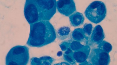 Tumour-trained T cells go on patrol