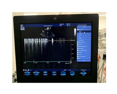 GE Healthcare - Ultrasound Machine | Vivid S6 Cardiac 