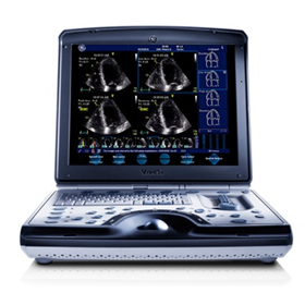Portable Ultrasound Scanner | Vivid i
