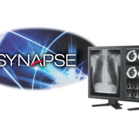 Mammography System | SYNAPSE PACS