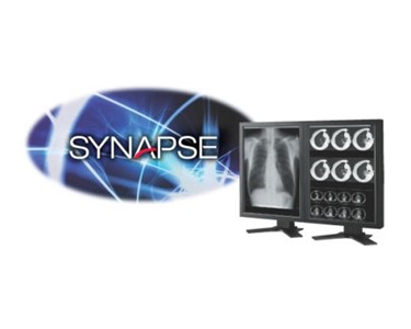 Fujifilm - Mammography System | SYNAPSE PACS