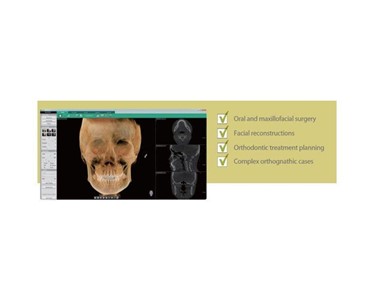 Vatech - Digital CBCT Dental 3D Imaging Systems | Green 21