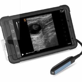 Bovine Veterinary Ultrasound 28th Day Pregnancy Detection -Bestscan S5