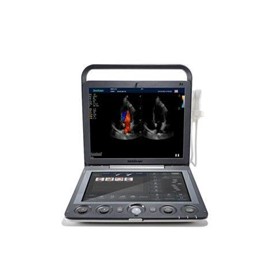Ultrasound System | S9