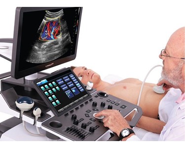 Ultrasound Machine | VINNO M80