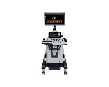 Siui - Ultrasound Machine | Apogee 5800 Ace