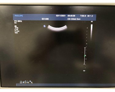 Philips - Ultrasound Probe | C5-1 Convex Transducer