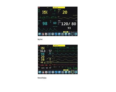 Northern Meditec - Pisces Multiparameter Patient Monitor