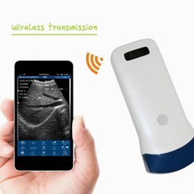 Wireless Ultrasound Scanner | Convex & Linear