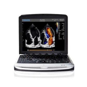 Portable Ultrasound Scanner Colour Doppler, Laptop | SonoBook