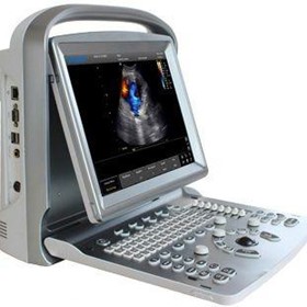 Portable Ultrasound Machine/Scanner ECO5 Colour Doppler 