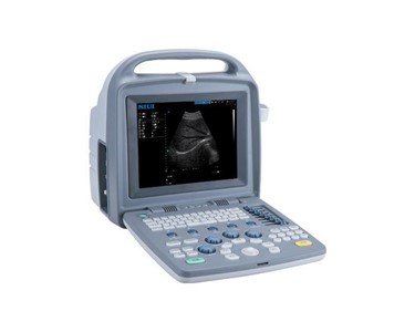 Ultrasound Machine | SIUI CTS 5500 Plus