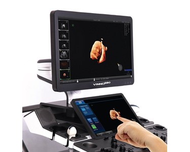 Ultrasound Machine | VINNO M80