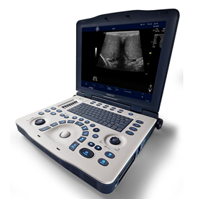 Portable Ultrasound System | LOGIQ V2