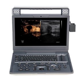 Portable Ultrasound Machine | Apogee C2  
