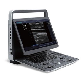 E1 Portable Ultrasound B/W