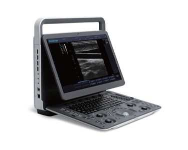 SonoScape - E1 Portable Ultrasound B/W