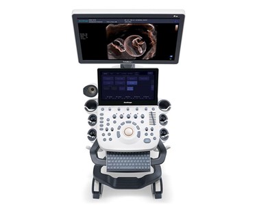 SonoScape - Ultrasound System | P20
