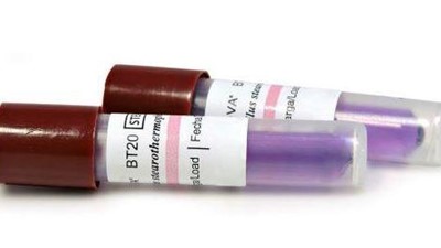 Different Options for Testing your Autoclave Cycle