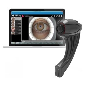 Dry Eye Analyser | ICP Ocular Surface Analyser
